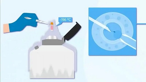 做一次試管嬰兒錢需要多少