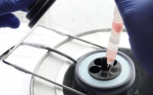 俄羅斯試管嬰兒費用受那些影響呢