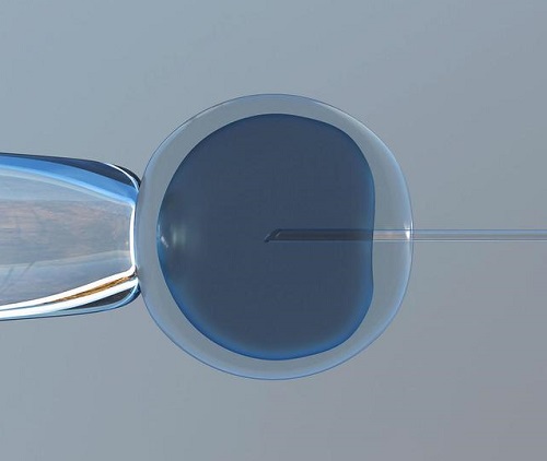 試管嬰兒費用大概要多少錢