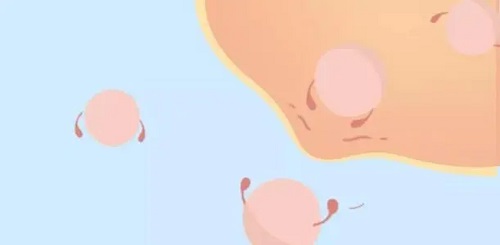 試管嬰兒不好的地方有什么