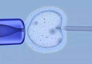 試管嬰兒中介的費用是多少