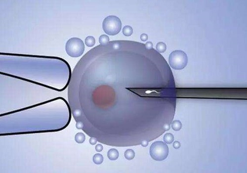 試管嬰兒全下來需要多少錢